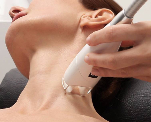 Elibelle_photo_Endermologie_Visage_4
